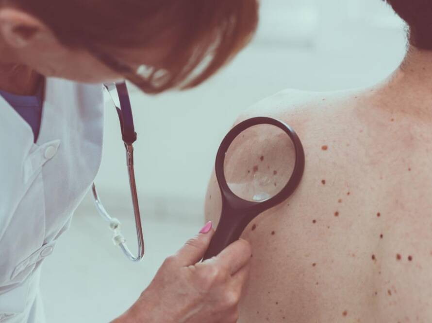 Skin Cancer consultation at Qidwai Clinic in Sydney